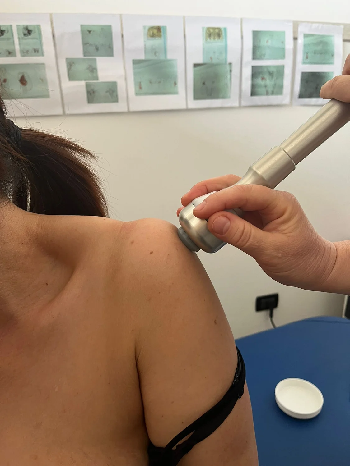 Trattamento onde d'urto presso Biotech Balance