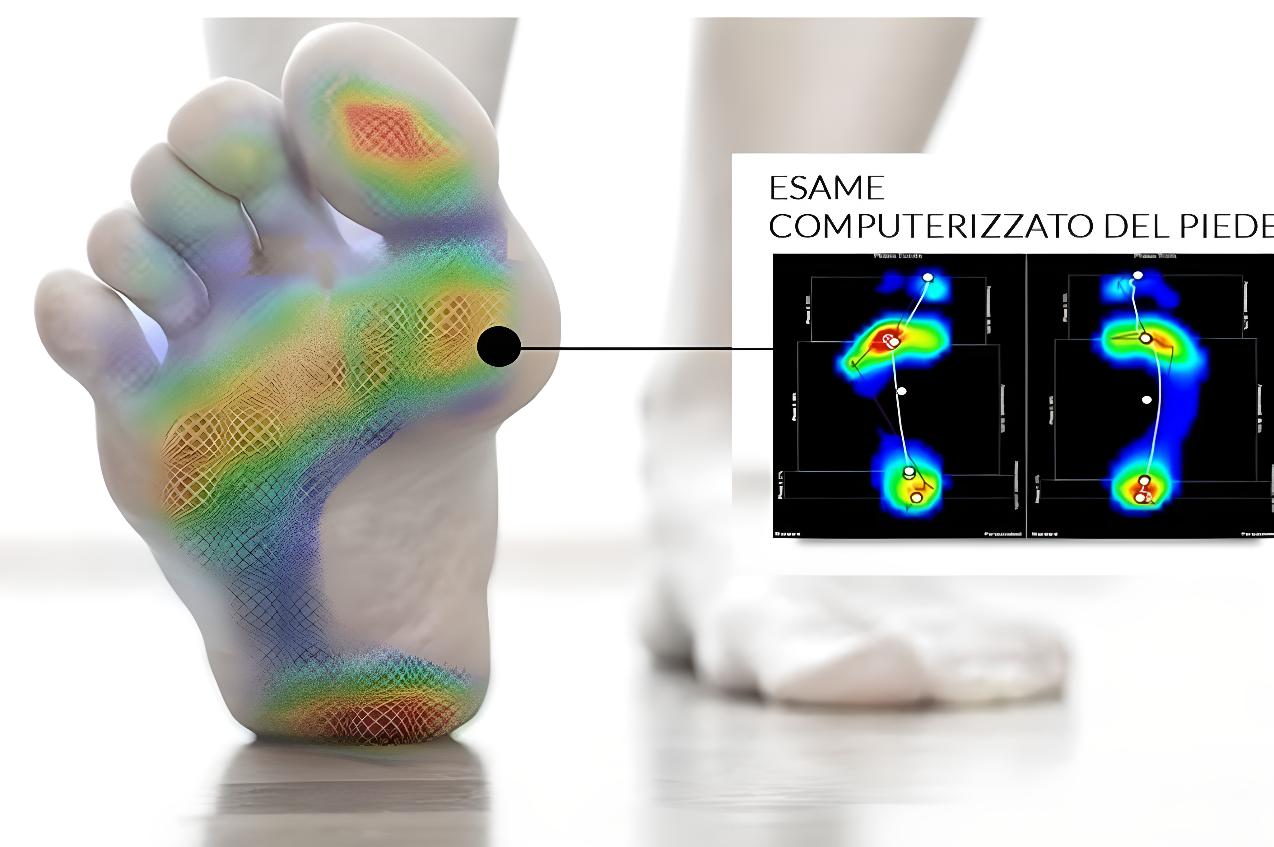 Esame computerizzato del piede - analisi baropodometrica