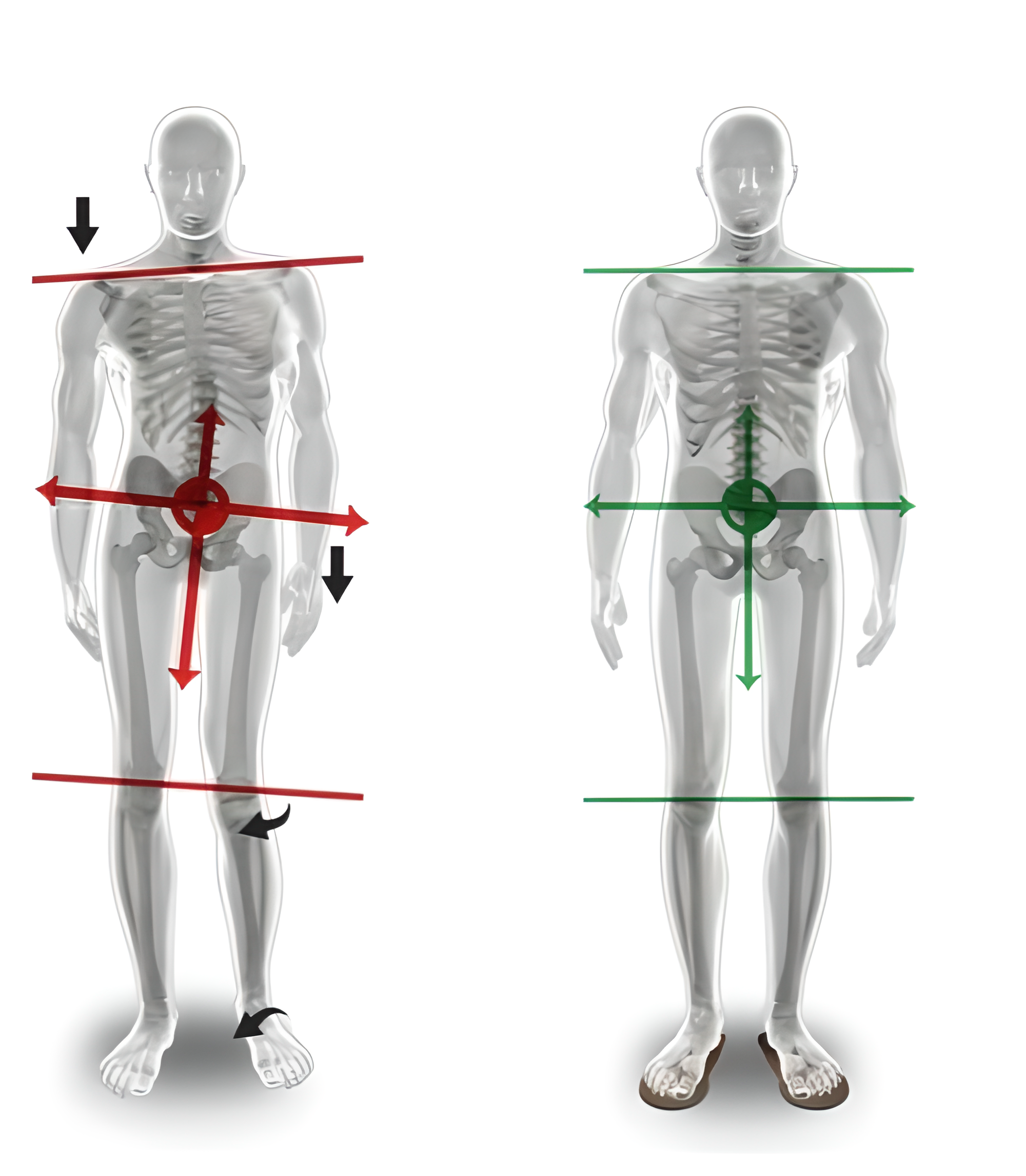 Valutazione posturale dinamica presso Biotech Balance - analisi squilibri biomeccanici